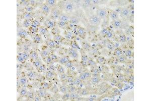 Immunohistochemistry of paraffin-embedded Mouse liver using HSD17B13 Polyclonal Antibody at dilution of 1:100 (40x lens). (HSD17B13 anticorps)