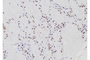 ABIN6276775 at 1/100 staining Human lung tissue by IHC-P.