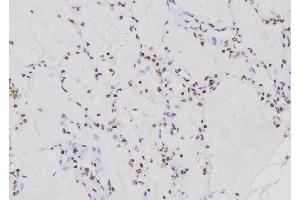 ABIN6276775 at 1/100 staining Human lung tissue by IHC-P. (RFC1 anticorps  (Internal Region))