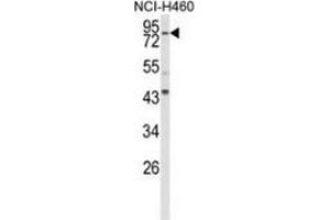 Western blot analysis of Spartin (arrow) in NCI-H460 cell line lysates (35ug/lane) using Spartin / SPG20  Antibody  (N-term). (SPG20 anticorps  (N-Term))