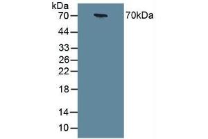 Detection of CHGA in Human Serum using Polyclonal Antibody to Chromogranin A (CHGA) (Chromogranin A anticorps  (AA 15-148))