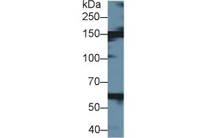 Western blot analysis of Cow Liver lysate, using Cow XDH Antibody (1 µg/ml) and HRP-conjugated Goat Anti-Rabbit antibody (