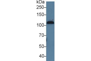 Western Blot; Sample: Human Serum; Primary Ab: 5µg/ml Rabbit Anti-Human C7 Antibody Second Ab: 0.