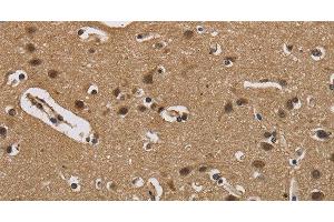 Immunohistochemistry of paraffin-embedded Human brain using FABP2 Polyclonal Antibody at dilution of 1:40