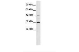 Image no. 2 for anti-Voltage-Dependent Anion Channel 1 (VDAC1) (C-Term) antibody (ABIN202157) (VDAC1 anticorps  (C-Term))