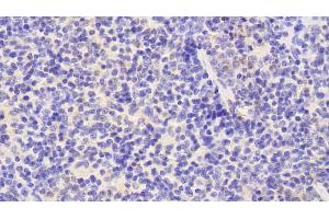 Detection of NB1 in Mouse Spleen Tissue using Polyclonal Antibody to Neutrophil Specific Antigen 1 (NB1)