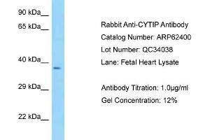 Western Blotting (WB) image for anti-Cytohesin 1 Interacting Protein (CYTIP) (N-Term) antibody (ABIN970496) (CYTIP anticorps  (N-Term))