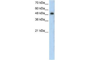 WB Suggested Anti-PRKCZ Antibody Titration:  0. (PKC zeta anticorps  (N-Term))