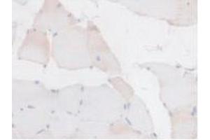 Detection of BCKDK in Rat Skeletal Muscle Tissue using Polyclonal Antibody to Branched Chain Alpha-Ketoacid Dehydrogenase Kinase (BCKDK) (BCKDK anticorps  (AA 44-223))