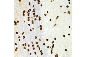 Immunohistochemistry of paraffin-embedded Rat brain using H3K27me2 antibody at dilution of 1:100 (x400 lens).