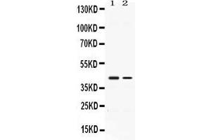 Western blot analysis of Abhd5 expression in rat kidney extract ( Lane 1) and A431 whole cell lysates ( Lane 2).