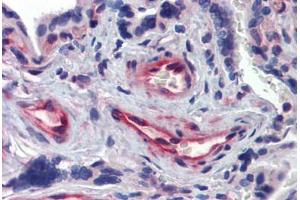 Human Placenta: Formalin-Fixed, Paraffin-Embedded (FFPE) (Akirin 1 anticorps  (N-Term))