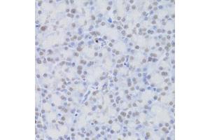 Immunohistochemistry of paraffin-embedded rat pancreas using JMJD6 Antibody (ABIN5973452) at dilution of 1/100 (40x lens). (JMJD6 anticorps)