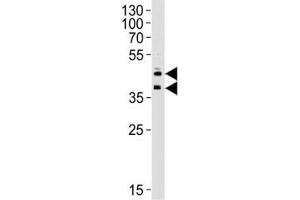 Western blot analysis of lysate from HUVEC cell line using CD34 antibody at 1:1000 for each lane.