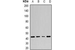 Western blot analysis of Adenosine Deaminase expression in A549 (A), Jurkat (B), mouse spleen (C), mouse stomach (D) whole cell lysates. (ADA anticorps)
