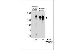 Western blot analysis of extracts from A431 cells,untreated or treated with EGF,100 ng/mL,using phospho ErbB2-(left) or ErbB2 Antibody (right) (ErbB2/Her2 anticorps  (pTyr1221))