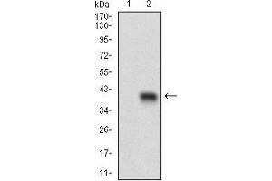 Western blot analysis using CD93 mAb against HEK293 (1) and CD93 (AA: 474-535)-hIgGFc transfected HEK293 (2) cell lysate. (CD93 anticorps  (AA 474-535))