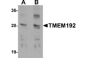 Western blot analysis of TMEM192 in SK-N-SH cell lysate with TMEM192 antibody at (A) 0. (TMEM192 anticorps  (C-Term))