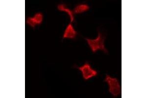 ABIN6269199 staining MCF7 by IF/ICC. (NFKBIA anticorps  (C-Term))