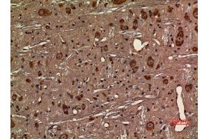 Immunohistochemistry (IHC) analysis of paraffin-embedded Rat Brain, antibody was diluted at 1:100. (CX3CR1 anticorps  (Internal Region))