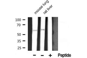 Western blot analysis of Akt1 phosphorylation expression in mouse lung and rat liver lysates,The lane on the right is treated with the antigen-specific peptide. (AKT1 anticorps  (pThr450))