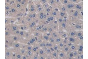 Detection of IL17RA in Mouse Liver Tissue using Polyclonal Antibody to Interleukin 17 Receptor A (IL17RA) (IL17RA anticorps  (AA 590-848))