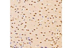 Immunohistochemistry of paraffin embedded mouse brain using DMRTA2 (ABIN7073753) at dilution of 1: 700 (400x lens)