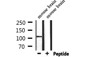 Western blot analysis of extracts from mouse brain, using CACNA2D4 Antibody. (CACNA2D4 anticorps  (Internal Region))