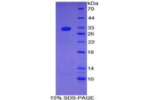 SDS-PAGE analysis of Rat Laminin gamma 1 Protein. (Laminin gamma 1 Protéine)