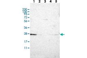 Western blot analysis of Lane 1: RT-4, Lane 2: U-251 MG, Lane 3: Human Plasma, Lane 4: Liver, Lane 5: Tonsil with TMED9 polyclonal antibody . (TMED9 anticorps)