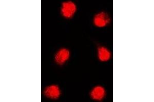 Immunofluorescent analysis of APTX staining in K562 cells. (Aprataxin anticorps)