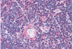 Human Thymus (formalin-fixed, paraffin-embedded) stained with CDC25B antibody ABIN214736 at 5 ug/ml followed by biotinylated goat anti-rabbit IgG secondary antibody ABIN481713, alkaline phosphatase-streptavidin and chromogen.