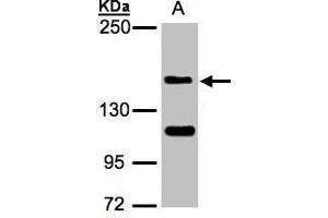 WB Image Sample(30 ug whole cell lysate) A:Raji , 5% SDS PAGE antibody diluted at 1:1000 (WHSC1 anticorps  (N-Term))