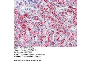 Immunohistochemistry with Human Liver cell lysate tissue at an antibody concentration of 5.