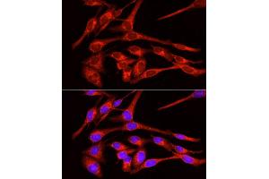 Immunofluorescence analysis of RD cells using GLUT4 antibody (ABIN6134112, ABIN6147963, ABIN6147964 and ABIN6223551) at dilution of 1:100 (40x lens).