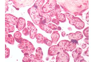 Human Placenta: Formalin-Fixed, Paraffin-Embedded (FFPE)