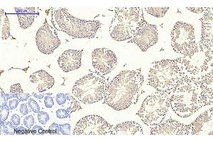 Immunohistochemical analysis of paraffin-embedded mouse testis tissue. (Dynamin 1-Like anticorps)