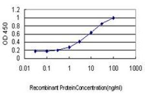 Detection limit for recombinant GST tagged STK17B is approximately 0.