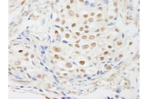 anti-Zinc Finger Protein 318 (Znf318) (AA 2049-2099) antibody