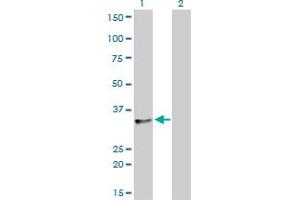 Western Blot analysis of SFRS10 expression in transfected 293T cell line by SFRS10 monoclonal antibody (M01), clone 7A1.