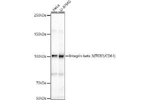 Western blot analysis of extracts of various cell lines, using Integrin beta 3 (ITGB3/CD61) antibody (ABIN6127571, ABIN6142583, ABIN6142585 and ABIN6213608) at 1:1000 dilution. (Integrin beta 3 anticorps  (AA 609-788))