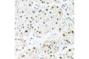 Immunohistochemistry of paraffin-embedded human stomach using BCCIP antibody.