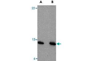 Western blot analysis of PSENEN in A-20 cell lysate with PSENEN polyclonal antibody  at (A) 0. (PEN2 anticorps  (N-Term))