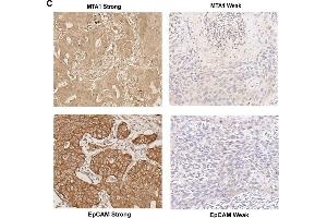 Expression of MTA1 and EpCAM in tissue microarray samples. (EpCAM anticorps  (AA 40-260))