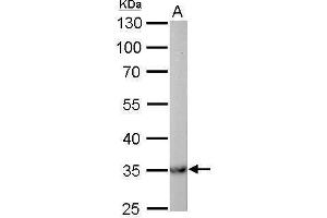 WB Image MDH2 antibody detects MDH2 protein by Western blot analysis.