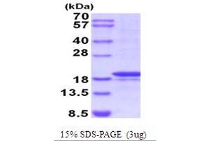 SDS-PAGE (SDS) image for Matrix Metallopeptidase 7 (Matrilysin, Uterine) (MMP7) (AA 95-267) protein (ABIN5854208)