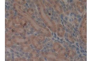 Detection of MMP3 in Rat Kidney Tissue using Monoclonal Antibody to Matrix Metalloproteinase 3 (MMP3)