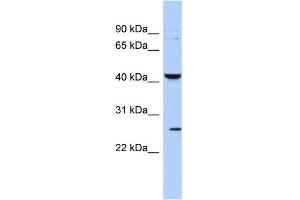 WB Suggested Anti-KCNMB4 Antibody Titration:  0. (KCNMB4 anticorps  (Middle Region))