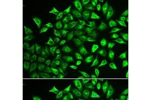 Immunofluorescence analysis of U2OS cells using MMRN1 Polyclonal Antibody