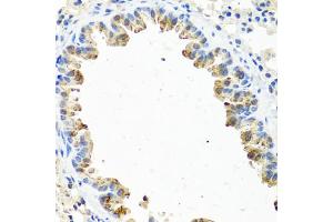 Immunohistochemistry of paraffin-embedded mouse lung using GNRH2 antibody.